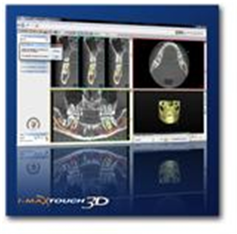 Dental Digital Tomographic Function