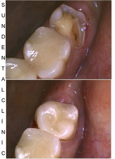 before&after