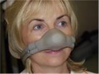 Inhalation Sedation (Laughing Gas)